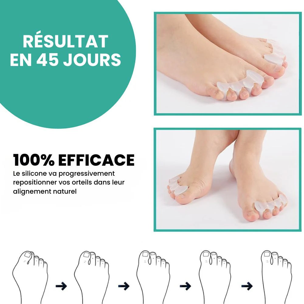 1 paire - Correcteur d'orteils en silicone