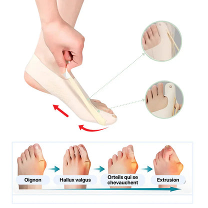 Orthèses Hallux Valgus