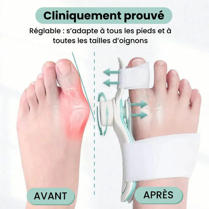 Correcteur d'hallux valgus